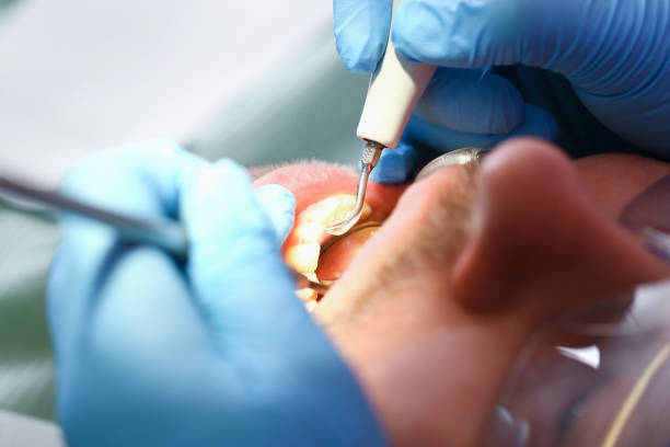 Best Emergency Broken Tooth Repair in Argos, IN